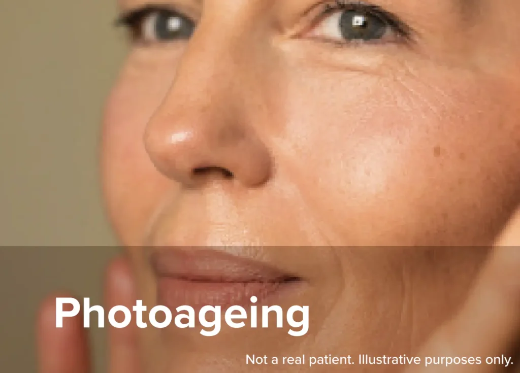 ReTrieve helps with photoageing