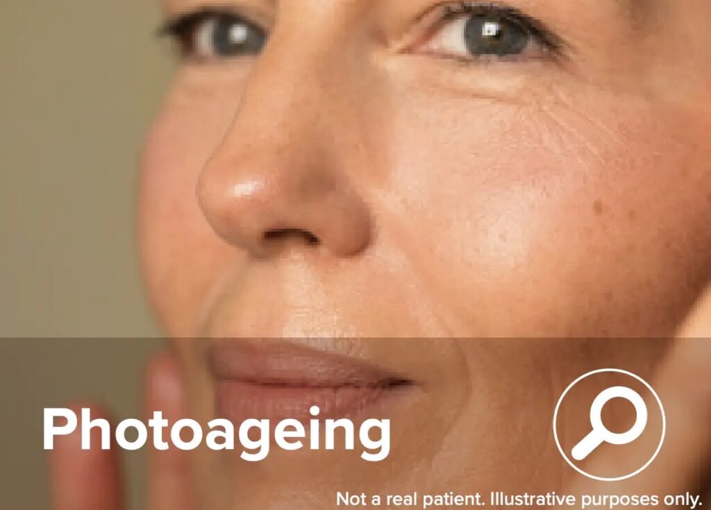 ReTrieve restores skin and improves Photoageing