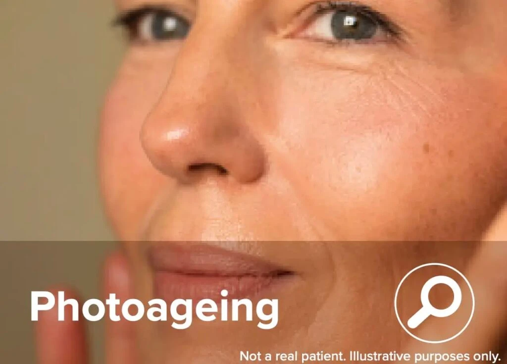 ReTrieve restores skin and improves Photoageing